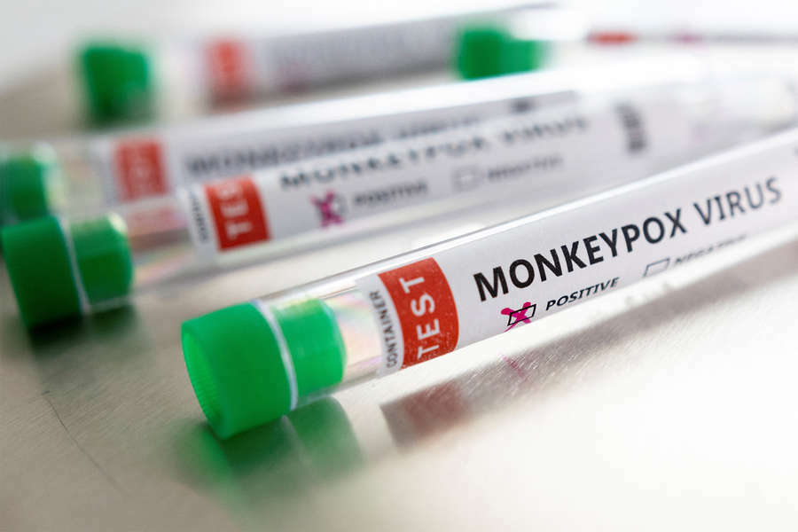 Вирусолог Волчков: вспышку оспы обезьян стоит признать пандемией